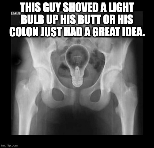 Lightbulb butt | THIS GUY SHOVED A LIGHT BULB UP HIS BUTT OR HIS COLON JUST HAD A GREAT IDEA. | image tagged in butt | made w/ Imgflip meme maker