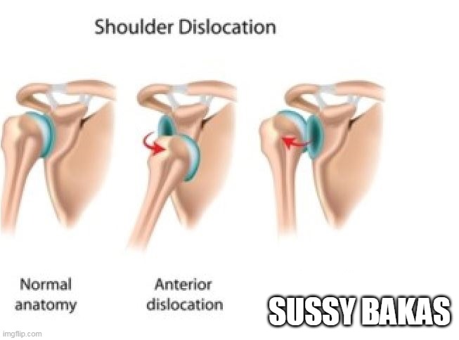 idk this meme | SUSSY BAKAS | image tagged in shoulder dislocation meme | made w/ Imgflip meme maker