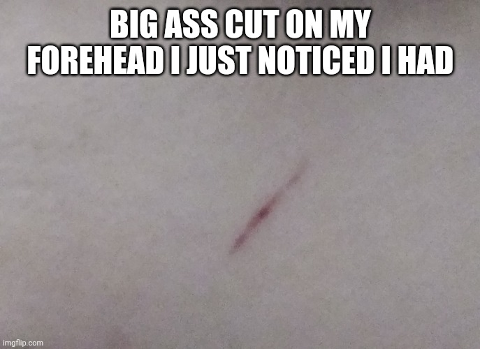 BIG ASS CUT ON MY FOREHEAD I JUST NOTICED I HAD | made w/ Imgflip meme maker