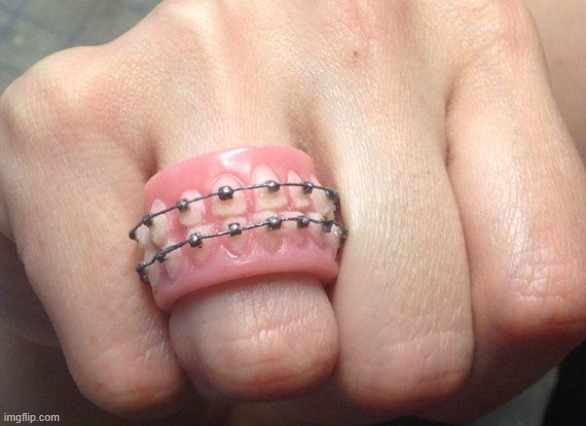 how about a braces teeth ring | image tagged in cursed image | made w/ Imgflip meme maker