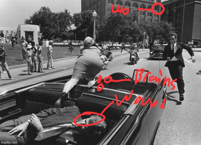 JFK assassination but I show you where the pieces of his brain are | image tagged in john f kennedy death | made w/ Imgflip meme maker