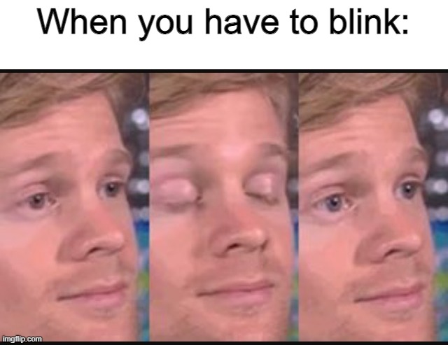Blinking guy | When you have to blink: | image tagged in blinking guy | made w/ Imgflip meme maker