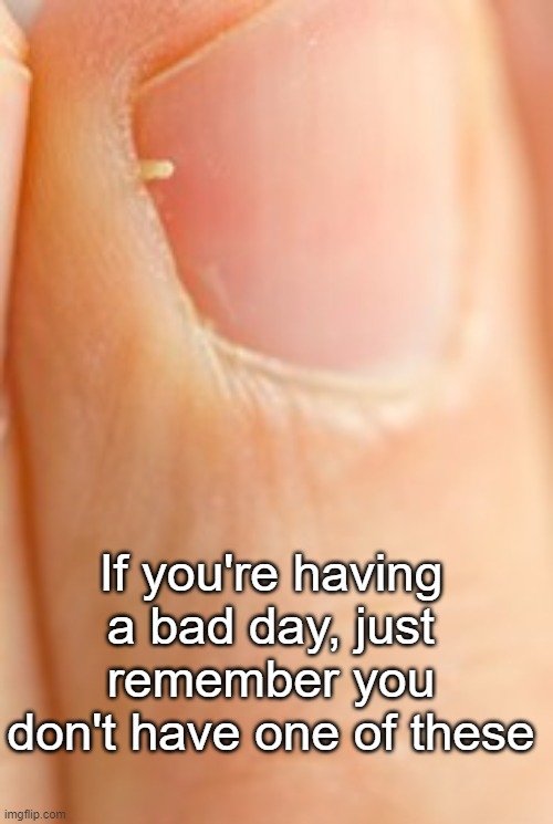 If you're having a bad day, just remember you don't have one of these | image tagged in memes,relatable,bad day,funny memes | made w/ Imgflip meme maker