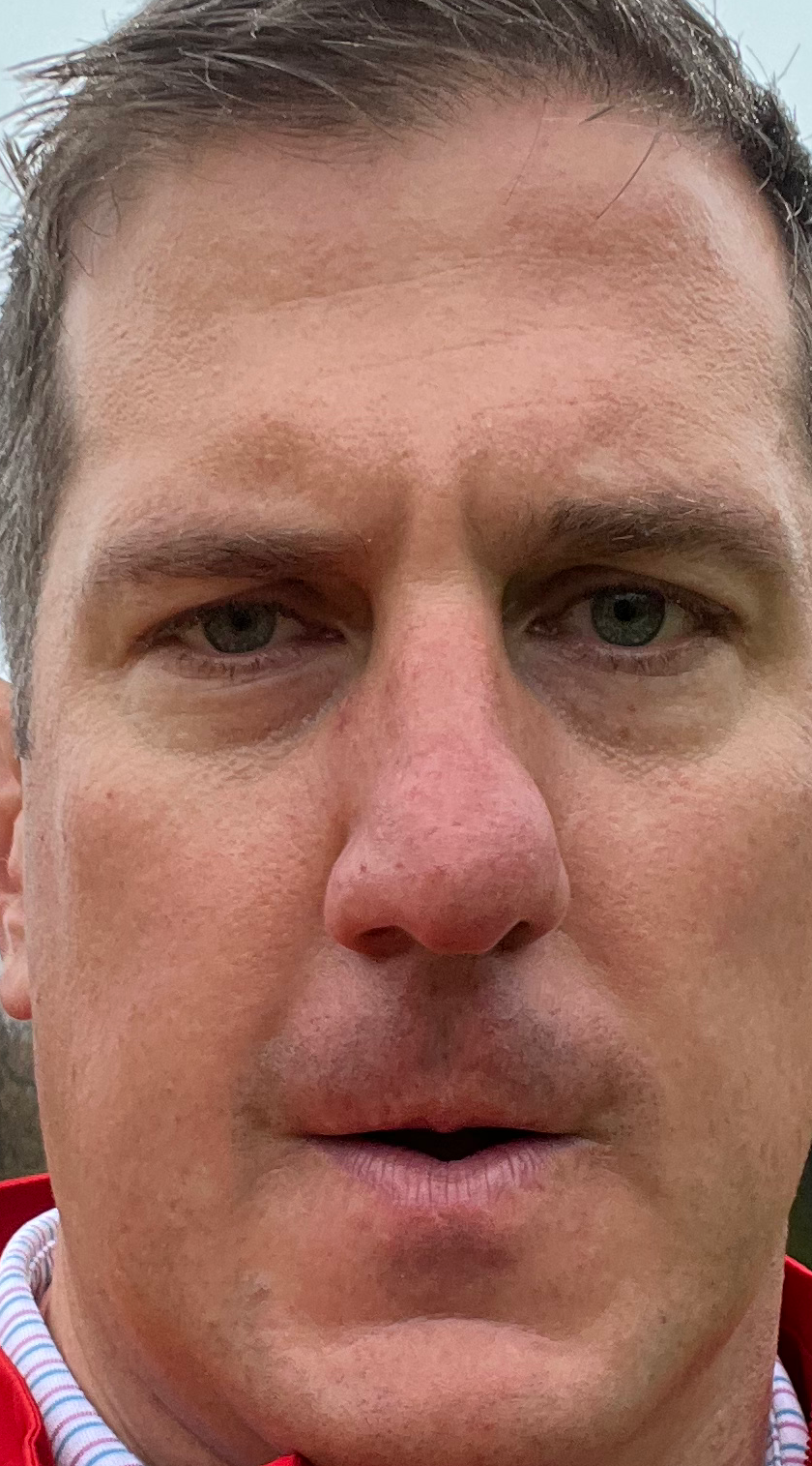 Todd Blank Meme Template