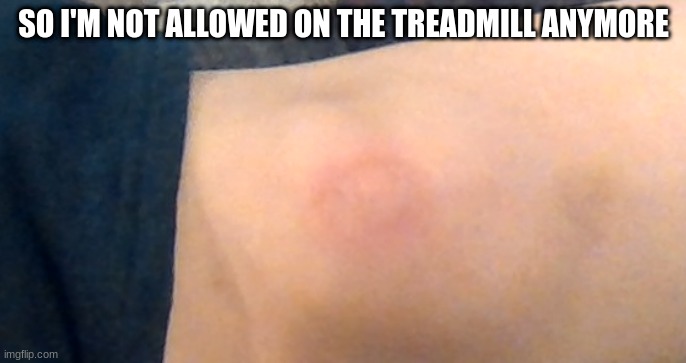 SO I'M NOT ALLOWED ON THE TREADMILL ANYMORE | made w/ Imgflip meme maker