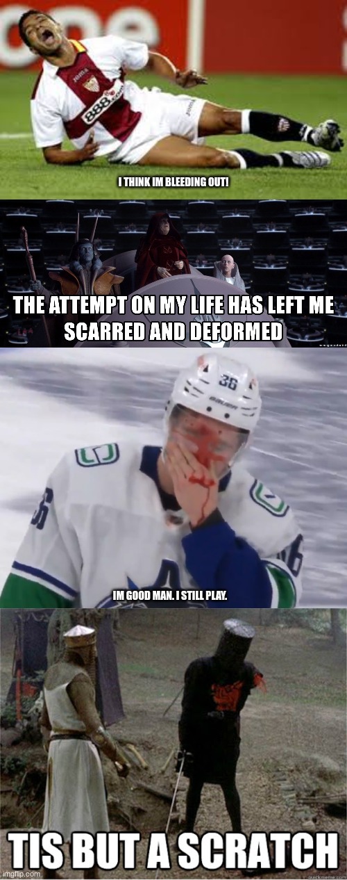 soccer players vs hockey players | I THINK IM BLEEDING OUT! IM GOOD MAN. I STILL PLAY. | image tagged in memes,soccer,ice hockey,the attempt on my life has left me scarred and deformed,tis but a scratch | made w/ Imgflip meme maker