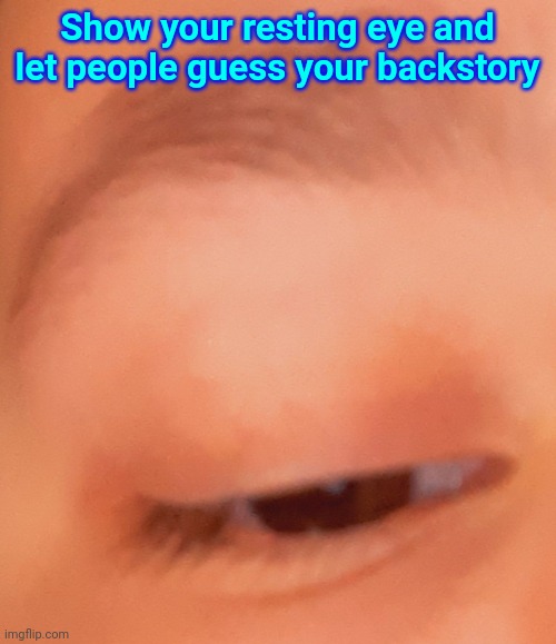Show your resting eye and let people guess your backstory | made w/ Imgflip meme maker