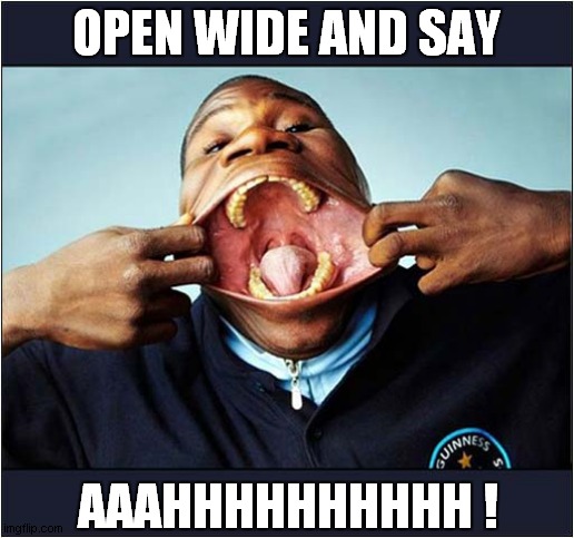 An Unusual Talent ! | OPEN WIDE AND SAY; AAAHHHHHHHHHH ! | image tagged in open wide,big mouth | made w/ Imgflip meme maker