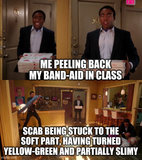 pizza fire meme | ME PEELING BACK MY BAND-AID IN CLASS SCAB BEING STUCK TO THE SOFT PART, HAVING TURNED YELLOW-GREEN AND PARTIALLY SLIMY | image tagged in pizza fire meme | made w/ Imgflip meme maker