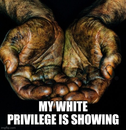 Dirty hands | MY WHITE PRIVILEGE IS SHOWING | image tagged in dirty hands | made w/ Imgflip meme maker