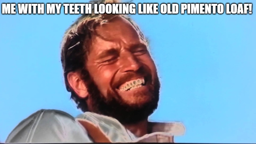 I NEED A CLEANING | ME WITH MY TEETH LOOKING LIKE OLD PIMENTO LOAF! | image tagged in charlton heston planet of the apes laugh | made w/ Imgflip meme maker