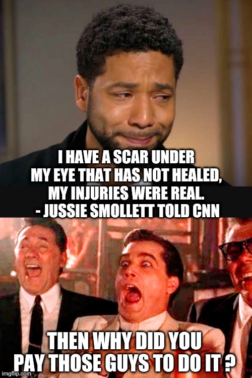 Whoops...did I do that? | I HAVE A SCAR UNDER MY EYE THAT HAS NOT HEALED, MY INJURIES WERE REAL.
 - JUSSIE SMOLLETT TOLD CNN; THEN WHY DID YOU PAY THOSE GUYS TO DO IT ? | image tagged in jussie smollett,liberals,cnn,lemon,democrats,blm | made w/ Imgflip meme maker