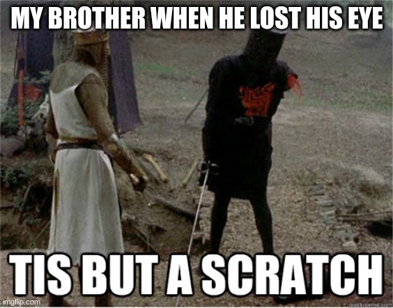tis but a scratch | MY BROTHER WHEN HE LOST HIS EYE | image tagged in tis but a scratch | made w/ Imgflip meme maker