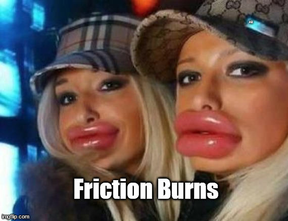 Friction |  A B; Friction Burns | image tagged in memes,duck face chicks,friction burns,bjs,kamala harris,big lips | made w/ Imgflip meme maker