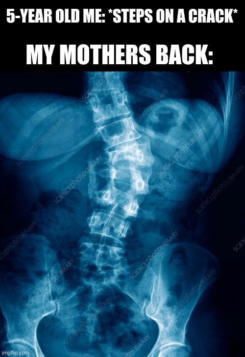 broken back | 5-YEAR OLD ME: *STEPS ON A CRACK*; MY MOTHERS BACK: | made w/ Imgflip meme maker
