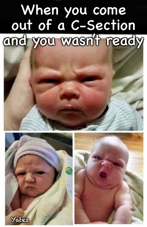 C-Section baby | When you come out of a C-Section and you wasn’t ready; Yates | image tagged in c-section | made w/ Imgflip meme maker