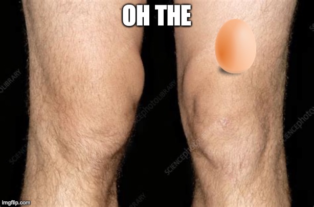 oh the... | OH THE | image tagged in egg on knee,agony,pun | made w/ Imgflip meme maker