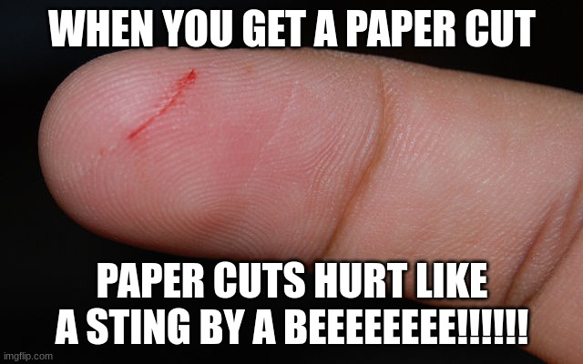 paper cut | WHEN YOU GET A PAPER CUT; PAPER CUTS HURT LIKE A STING BY A BEEEEEEEE!!!!!! | image tagged in paper cut | made w/ Imgflip meme maker