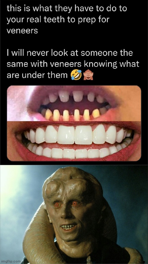 Twi’leks | image tagged in dentist,funny memes,star wars,aliens,lol,teeth | made w/ Imgflip meme maker