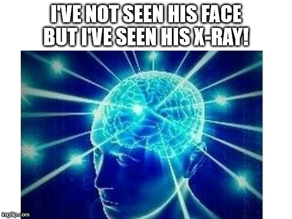 I'VE NOT SEEN HIS FACE BUT I'VE SEEN HIS X-RAY! | made w/ Imgflip meme maker