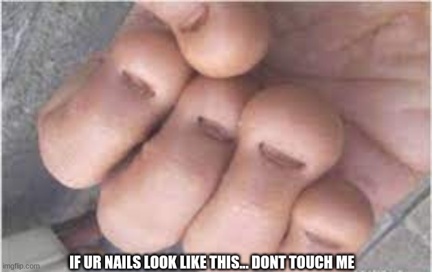 respectfully | IF UR NAILS LOOK LIKE THIS... DONT TOUCH ME | image tagged in nasty,spit | made w/ Imgflip meme maker