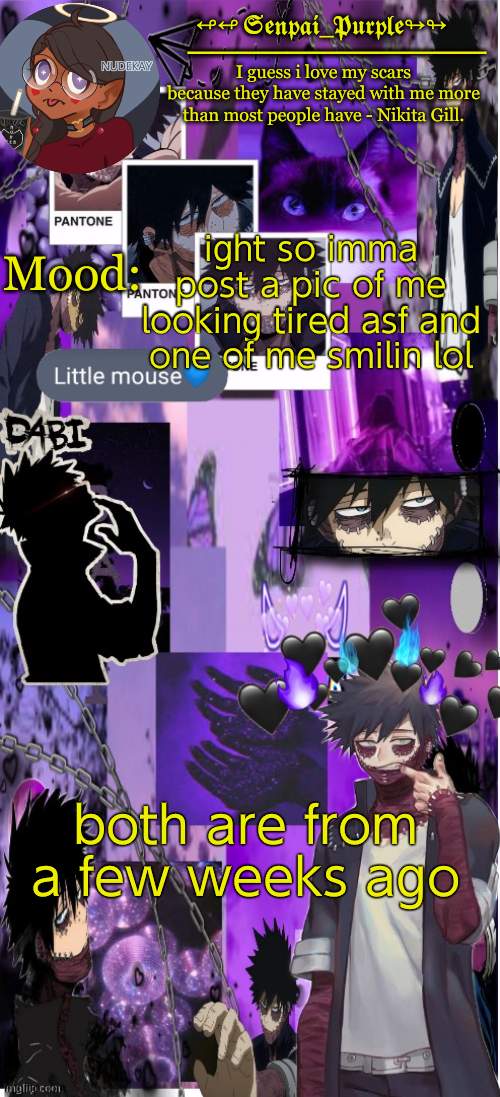 Dabi Temp :D | ight so imma post a pic of me looking tired asf and one of me smilin lol; both are from a few weeks ago | image tagged in yes i made this a temp yet another anime boy temp uwu | made w/ Imgflip meme maker