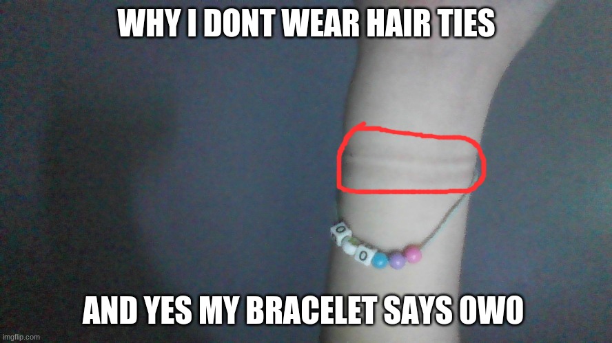 it hurts | WHY I DONT WEAR HAIR TIES; AND YES MY BRACELET SAYS 0W0 | image tagged in oh wow are you actually reading these tags,i have no idea what i am doing | made w/ Imgflip meme maker