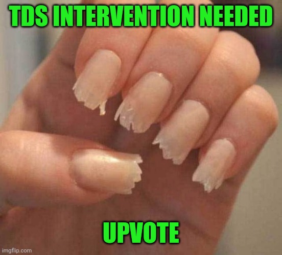 TDS INTERVENTION NEEDED UPVOTE | made w/ Imgflip meme maker