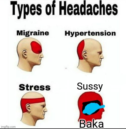 Loooooooooolooooooolooooooooooool | Sussy; Baka | image tagged in types of headaches meme | made w/ Imgflip meme maker