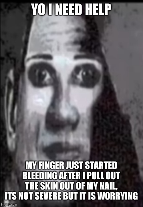 :oof: | YO I NEED HELP; MY FINGER JUST STARTED BLEEDING AFTER I PULL OUT THE SKIN OUT OF MY NAIL, ITS NOT SEVERE BUT IT IS WORRYING | made w/ Imgflip meme maker