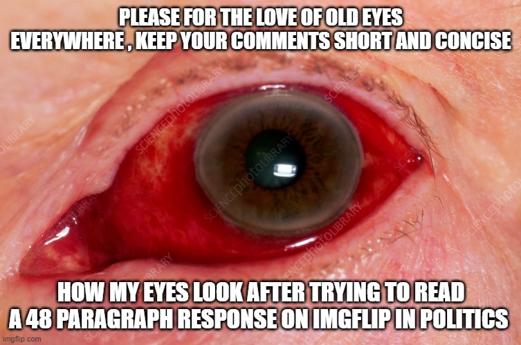 anyone got some visine?? | PLEASE FOR THE LOVE OF OLD EYES EVERYWHERE , KEEP YOUR COMMENTS SHORT AND CONCISE; HOW MY EYES LOOK AFTER TRYING TO READ A 48 PARAGRAPH RESPONSE ON IMGFLIP IN POLITICS | image tagged in letsgetwordy,funny memes,truth,political meme,politics lol,stupid liberals | made w/ Imgflip meme maker