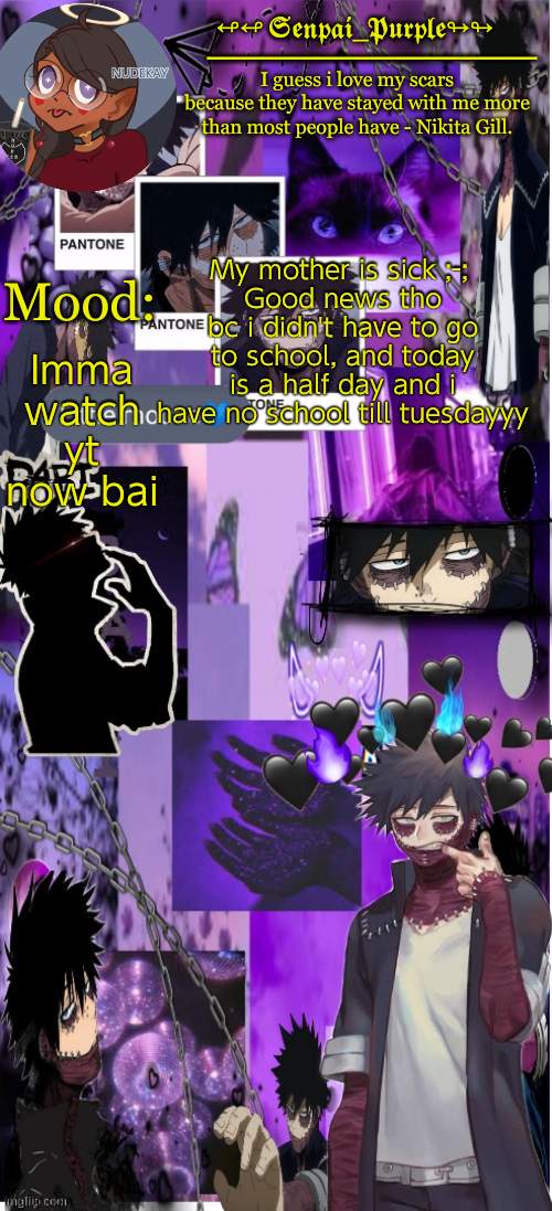 Dabi Temp :D | My mother is sick ;-; 
Good news tho bc i didn't have to go to school, and today is a half day and i have no school till tuesdayyy; Imma watch yt now bai | image tagged in yes i made this a temp yet another anime boy temp uwu | made w/ Imgflip meme maker