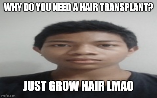 been seeing ads about hair transplant | WHY DO YOU NEED A HAIR TRANSPLANT? JUST GROW HAIR LMAO | image tagged in akif | made w/ Imgflip meme maker