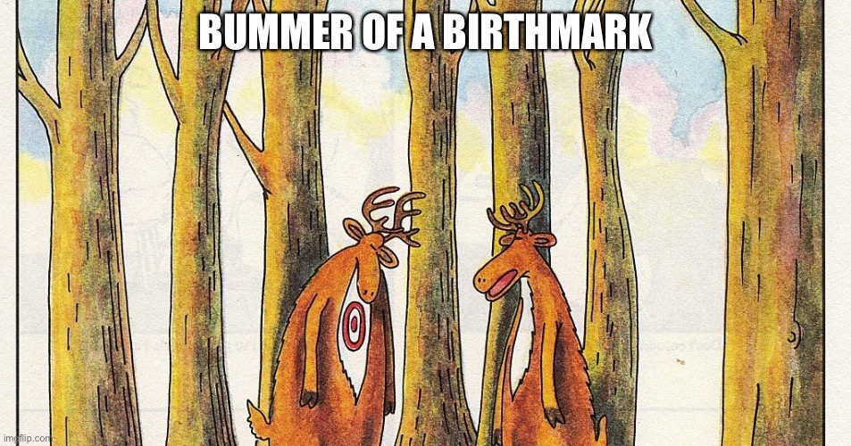 Birthmark | BUMMER OF A BIRTHMARK | image tagged in birthmark | made w/ Imgflip meme maker