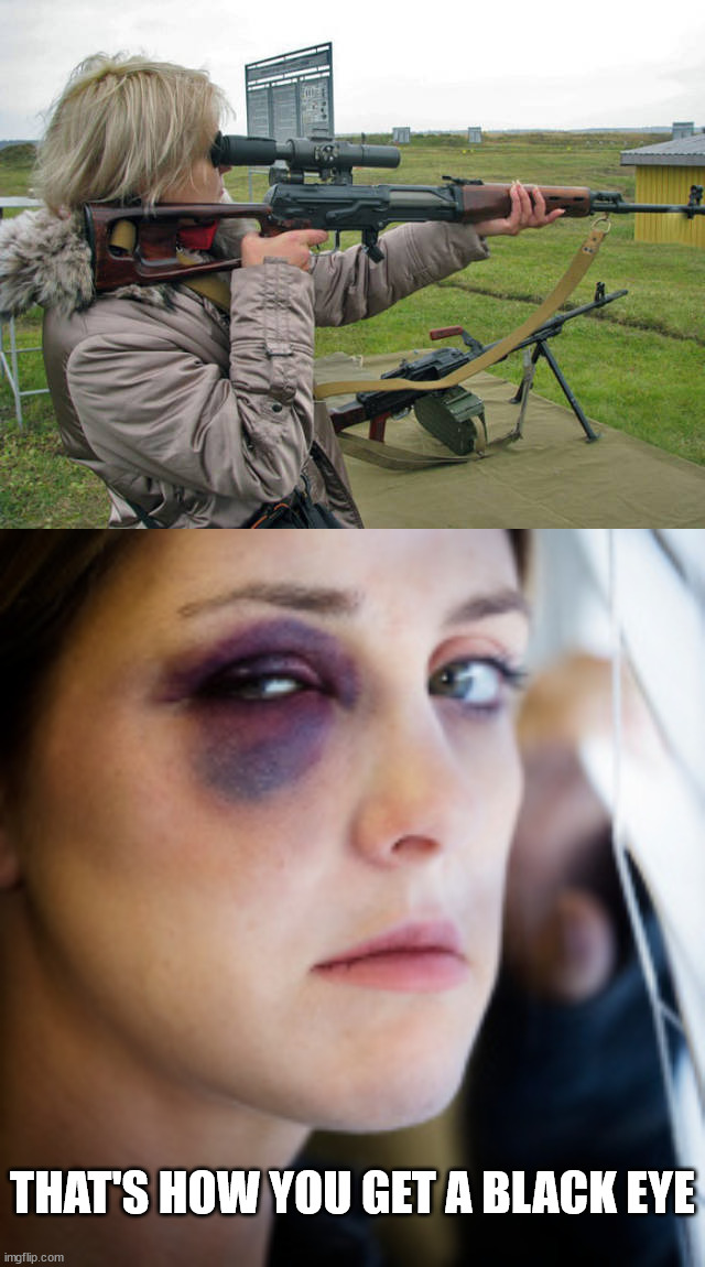 THAT'S HOW YOU GET A BLACK EYE | image tagged in black eye,weapons | made w/ Imgflip meme maker