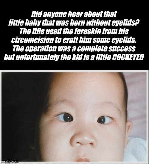 Did anyone hear about that little baby that was born without eyelids? The DRs used the foreskin from his circumcision to craft him some eyelids. The operation was a complete success but unfortunately the kid is a little COCKEYED | image tagged in no eyelids,cockeyed | made w/ Imgflip meme maker