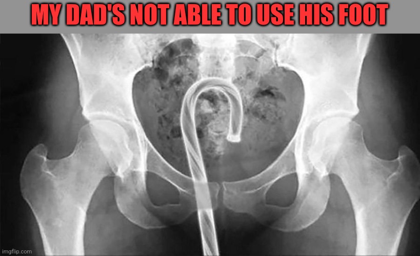 MY DAD'S NOT ABLE TO USE HIS FOOT | made w/ Imgflip meme maker
