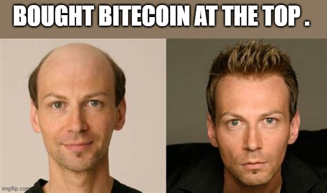 BITEcoin | BOUGHT BITECOIN AT THE TOP . | image tagged in bite | made w/ Imgflip meme maker