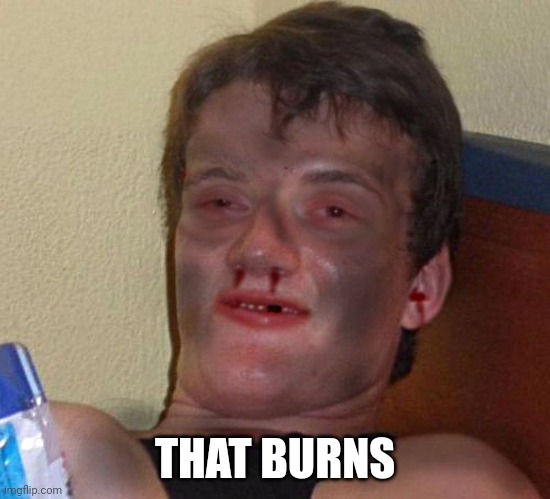 Burnt 10 Guy | THAT BURNS | image tagged in burnt 10 guy | made w/ Imgflip meme maker