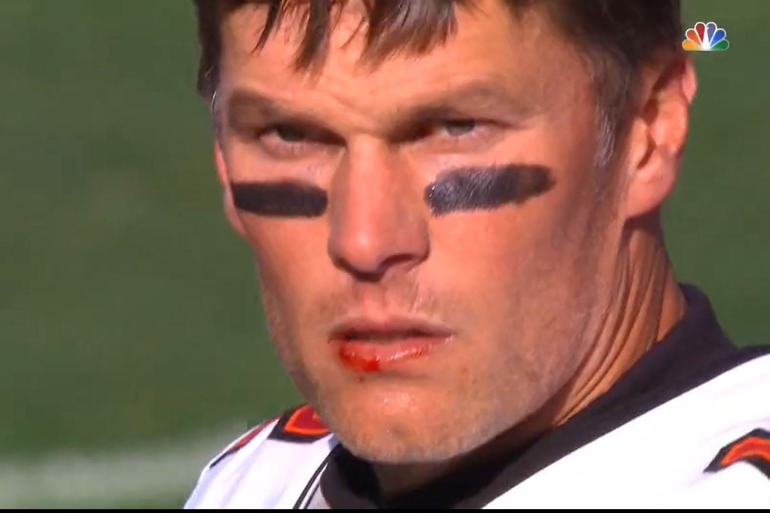 High Quality Tom Brady bloody lip Blank Meme Template