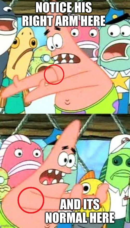 it l00k like it detach | NOTICE HIS RIGHT ARM HERE; AND ITS NORMAL HERE | image tagged in memes,put it somewhere else patrick | made w/ Imgflip meme maker