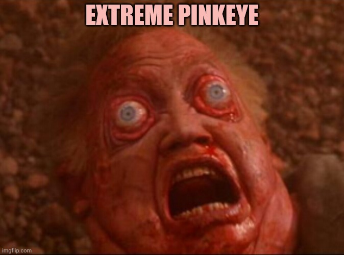 Pink eye | EXTREME PINKEYE | image tagged in pink eye | made w/ Imgflip meme maker