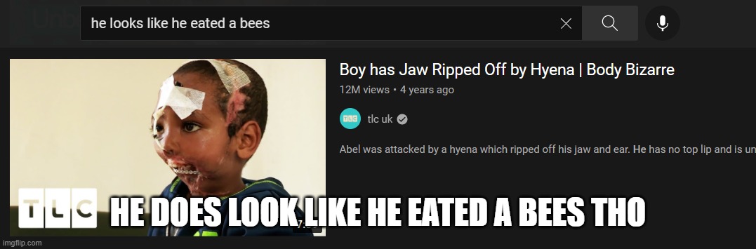 HE DOES LOOK LIKE HE EATED A BEES THO | made w/ Imgflip meme maker