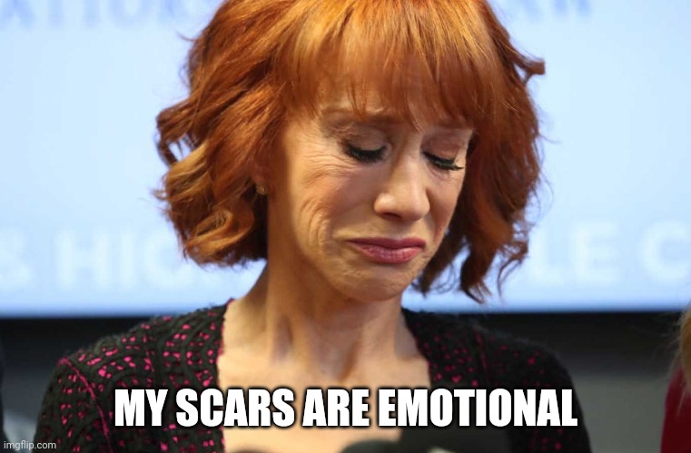 Kathy Griffin Crying | MY SCARS ARE EMOTIONAL | image tagged in kathy griffin crying | made w/ Imgflip meme maker