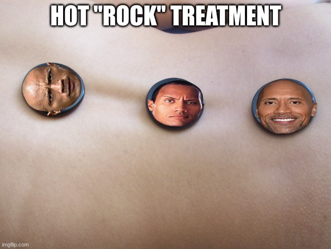 hot "rock" treatment | HOT "ROCK" TREATMENT | image tagged in the rock,dwayne johnson | made w/ Imgflip meme maker