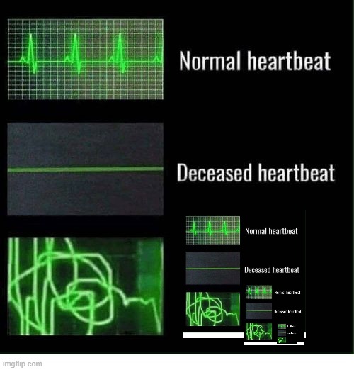 Heartbeatception | image tagged in normal heartbeat deceased heartbeat,inception,recursion | made w/ Imgflip meme maker