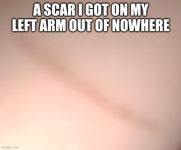 A SCAR I GOT ON MY LEFT ARM OUT OF NOWHERE | made w/ Imgflip meme maker