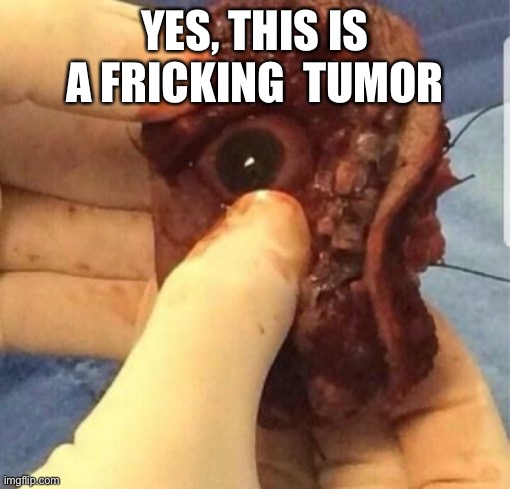 YES, THIS IS A FRICKING  TUMOR | made w/ Imgflip meme maker