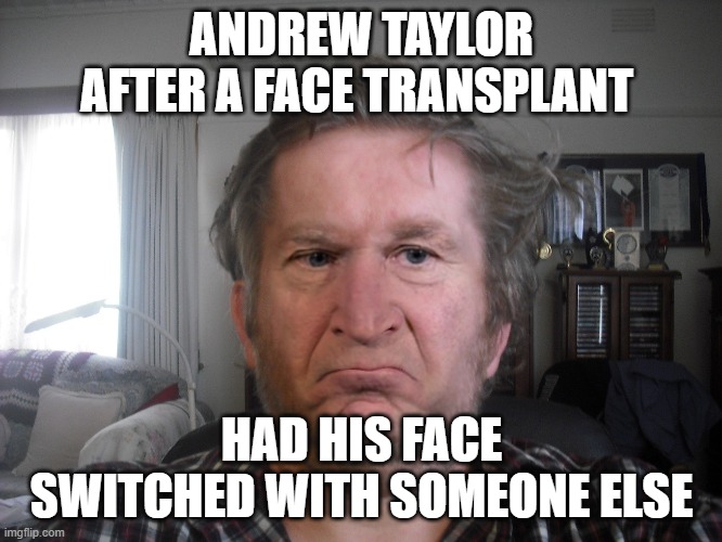 Andrew | ANDREW TAYLOR AFTER A FACE TRANSPLANT; HAD HIS FACE SWITCHED WITH SOMEONE ELSE | image tagged in andrew taylor new face | made w/ Imgflip meme maker