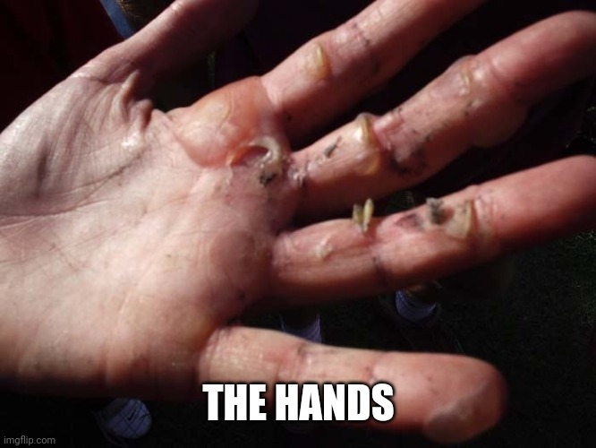 ugly hand | THE HANDS | image tagged in ugly hand | made w/ Imgflip meme maker